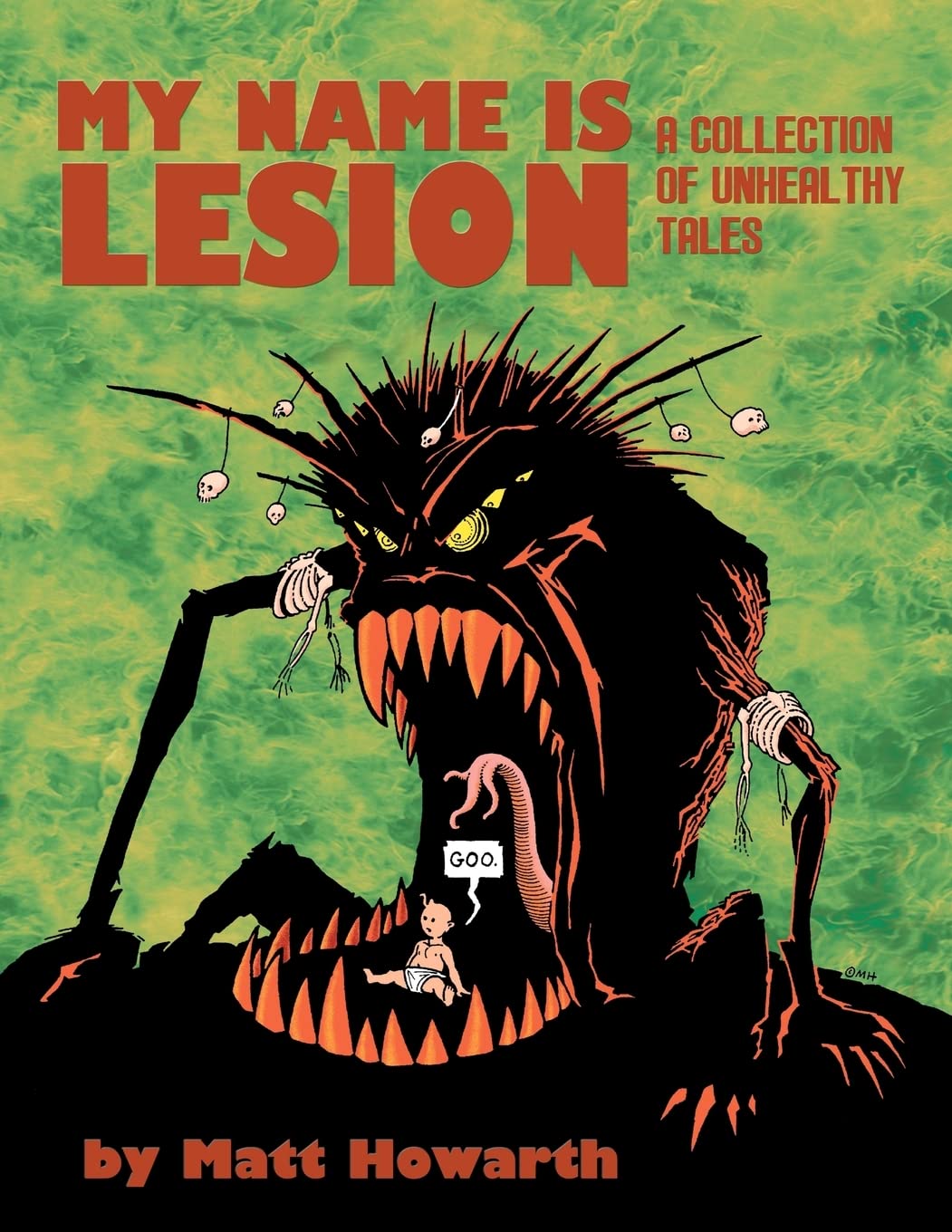 My Name Is Lesion: A Collection Of Unhealthy Tales,Used