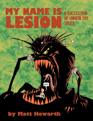 My Name Is Lesion: A Collection Of Unhealthy Tales,Used
