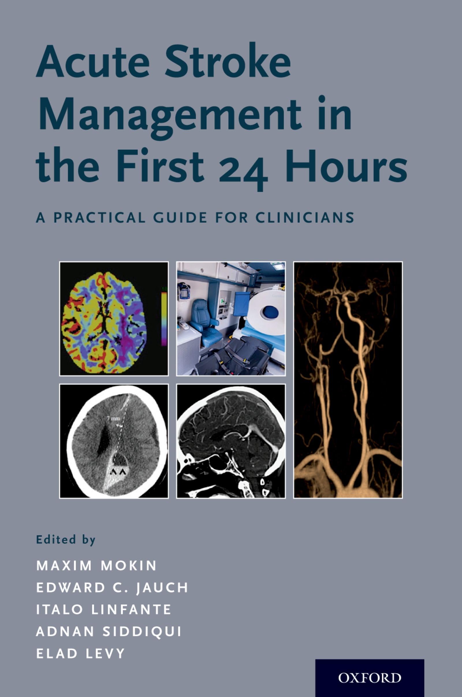 Acute Stroke Management in the First 24 Hours: A Practical Guide for Clinicians,Used