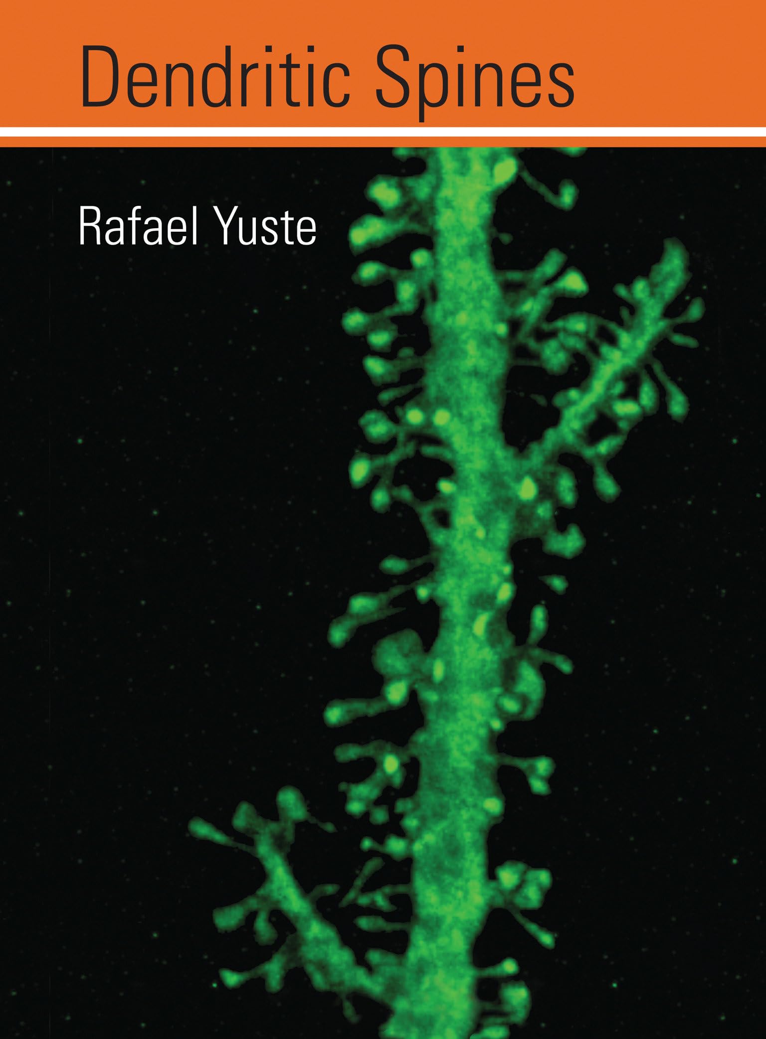 Dendritic Spines,Used