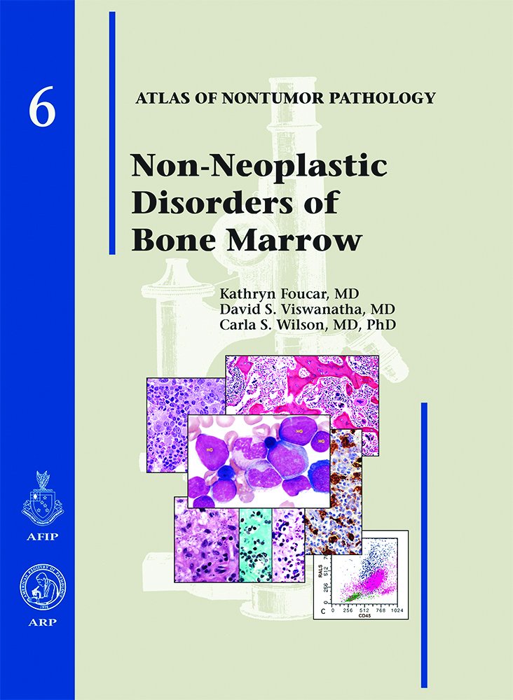 Atlas of Nontumor Pathology: NonNeoplastic Disorders of Bone Marrow (Atlas of Nontumor Pathology. First),Used