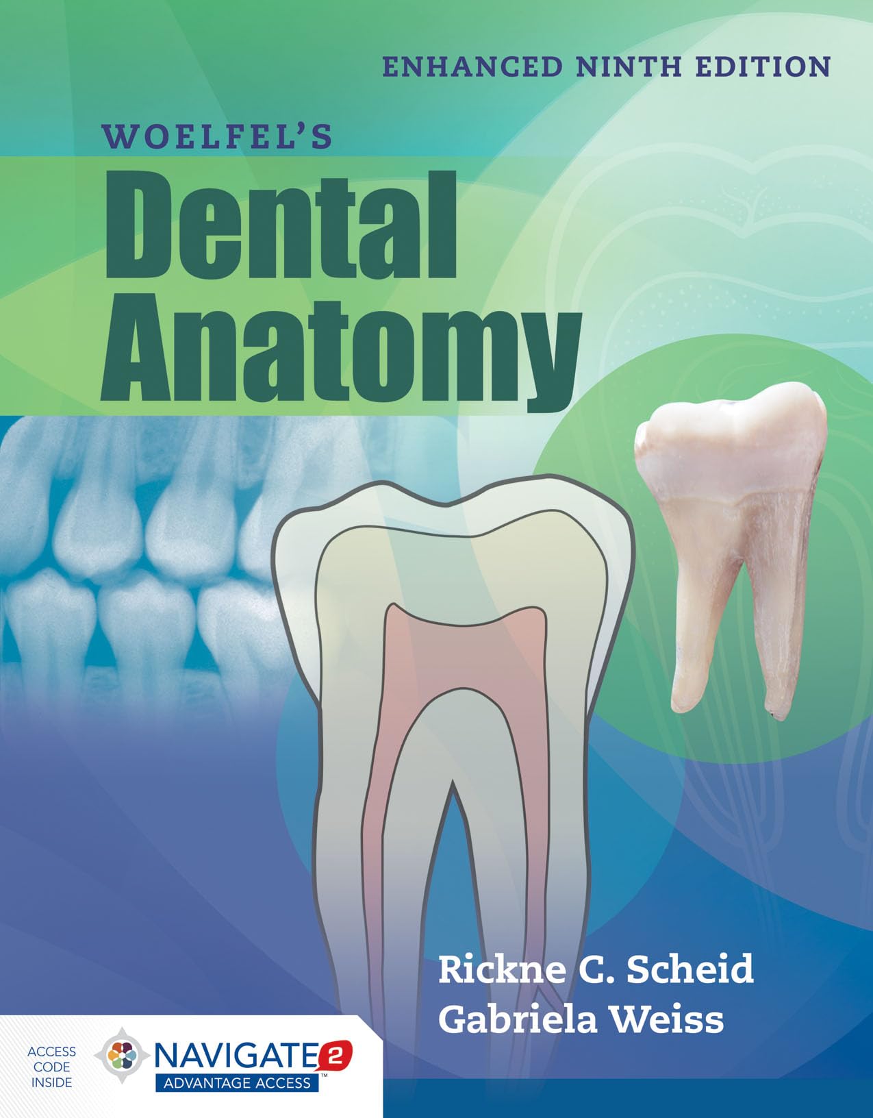 Woelfel's Dental Anatomy, Enhanced Edition,Used