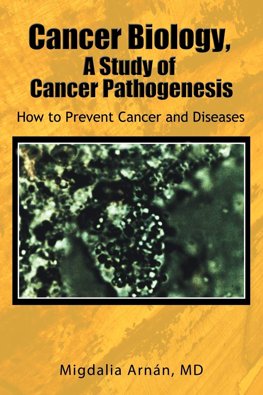 Cancer Biology, A Study of Cancer Pathogenesis: How to Prevent Cancer and Diseases,New