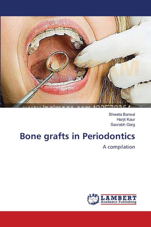 Bone grafts in Periodontics: A compilation,Used
