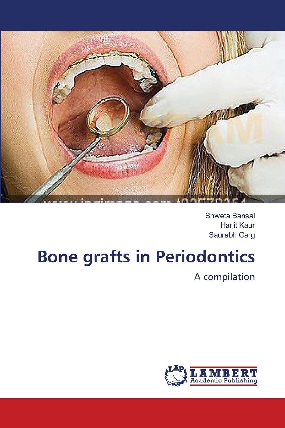 Bone grafts in Periodontics: A compilation,Used