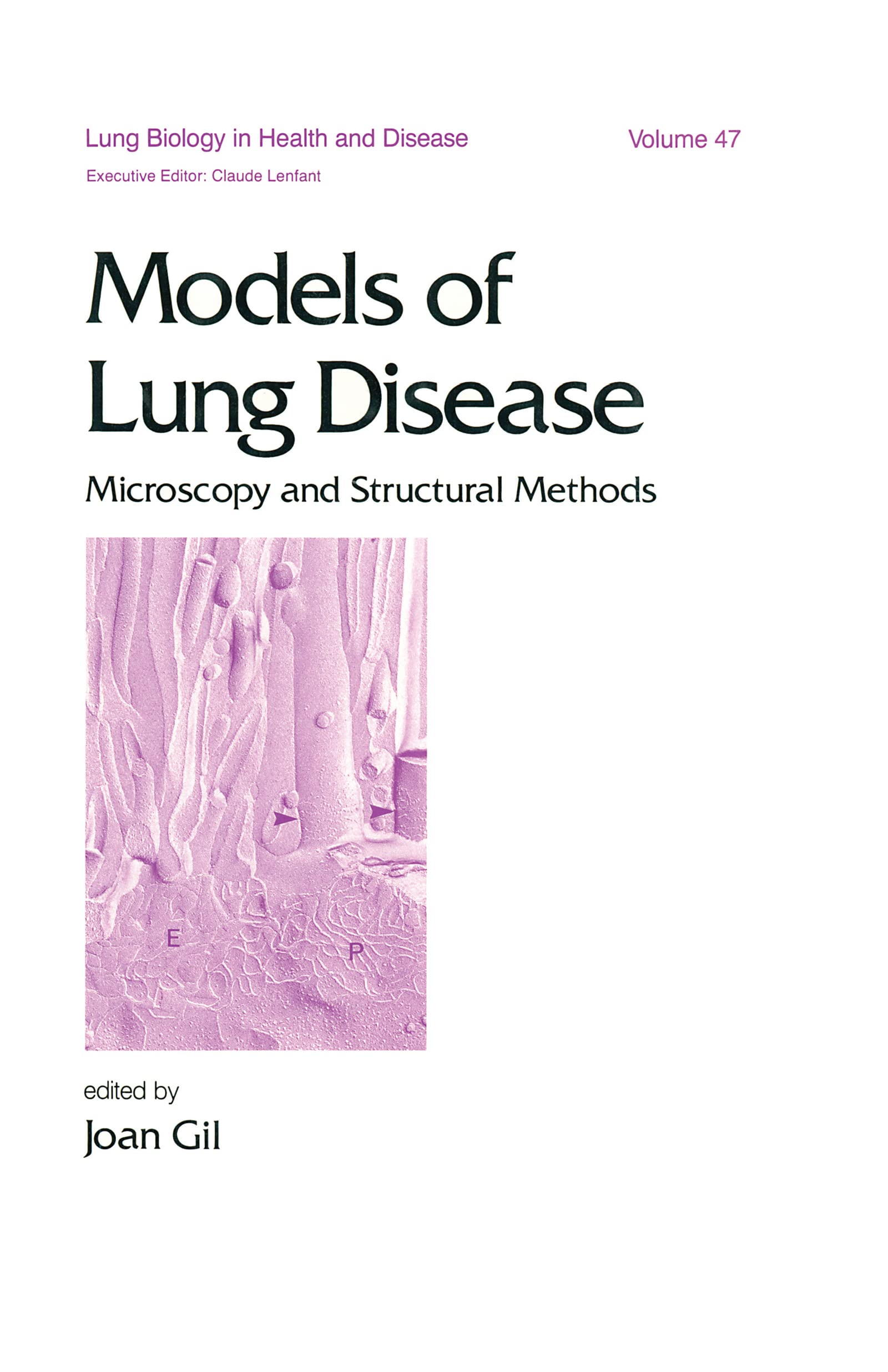Models of Lung Disease: Microscopy and Structural Methods (Lung Biology in Health and Disease),Used