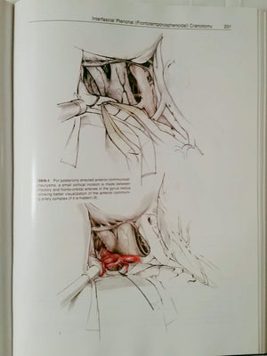 Microneurosurgery,Used