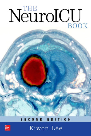 The NeuroICU Book, Second Edition,Used