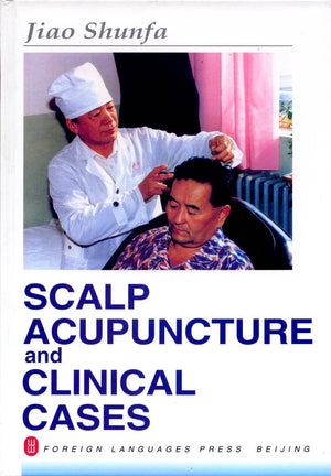 Scalp Acupuncture And Clinical Cases,Used