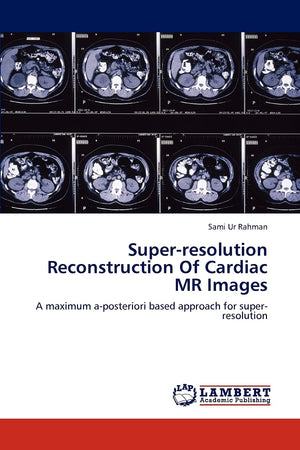 Superresolution Reconstruction Of Cardiac MR Images: A maximum aposteriori based approach for superresolution,Used