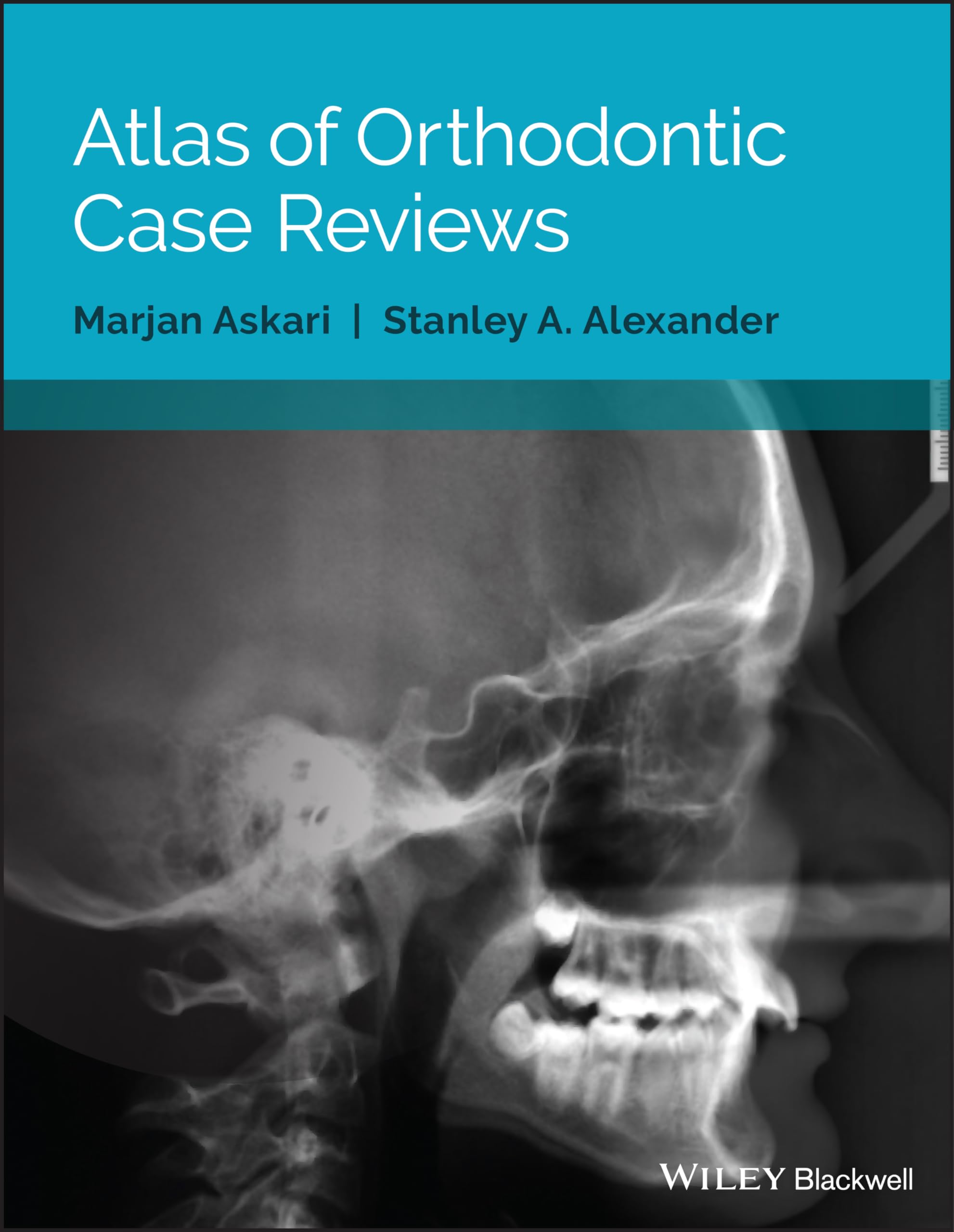 Atlas of Orthodontic Case Reviews,Used