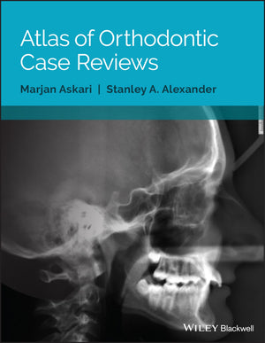 Atlas of Orthodontic Case Reviews,Used