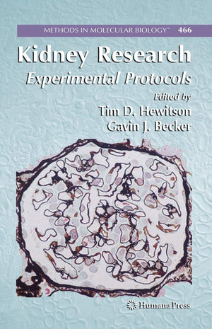 Kidney Research: Experimental Protocols (Methods In Molecular Biology, 466)