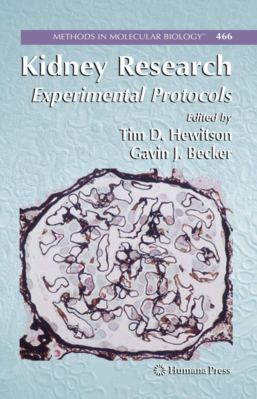 Kidney Research: Experimental Protocols (Methods In Molecular Biology, 466)