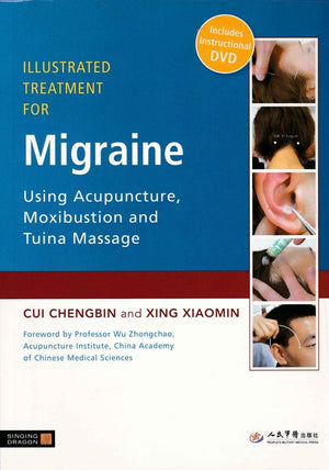 Illustrated Treatment for Migraine Using Acupuncture, Moxibustion and Tuina Massage,New