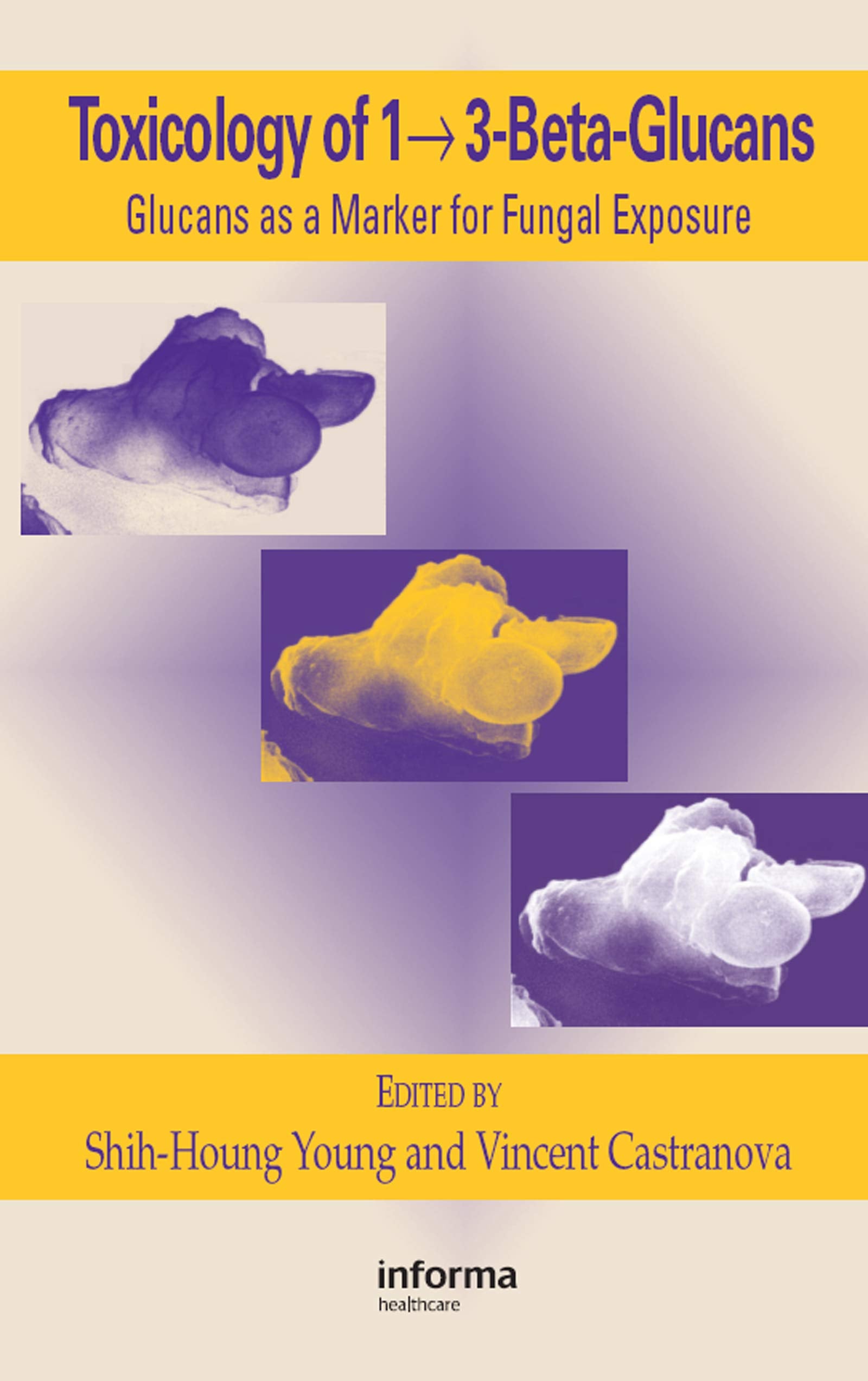 Toxicology of 1  3BetaGlucans: Glucans as a Marker for Fungal Exposure,Used
