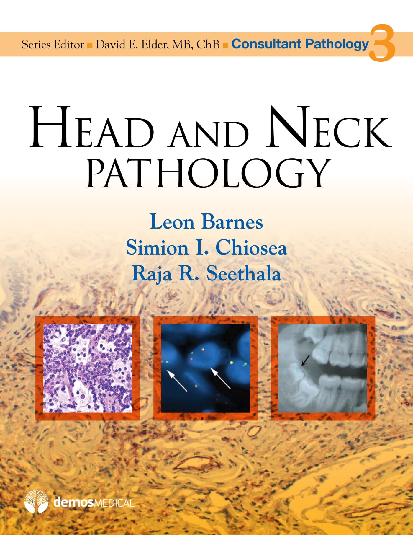 Head and Neck Pathology (Consultant Pathology, Volume 3),Used