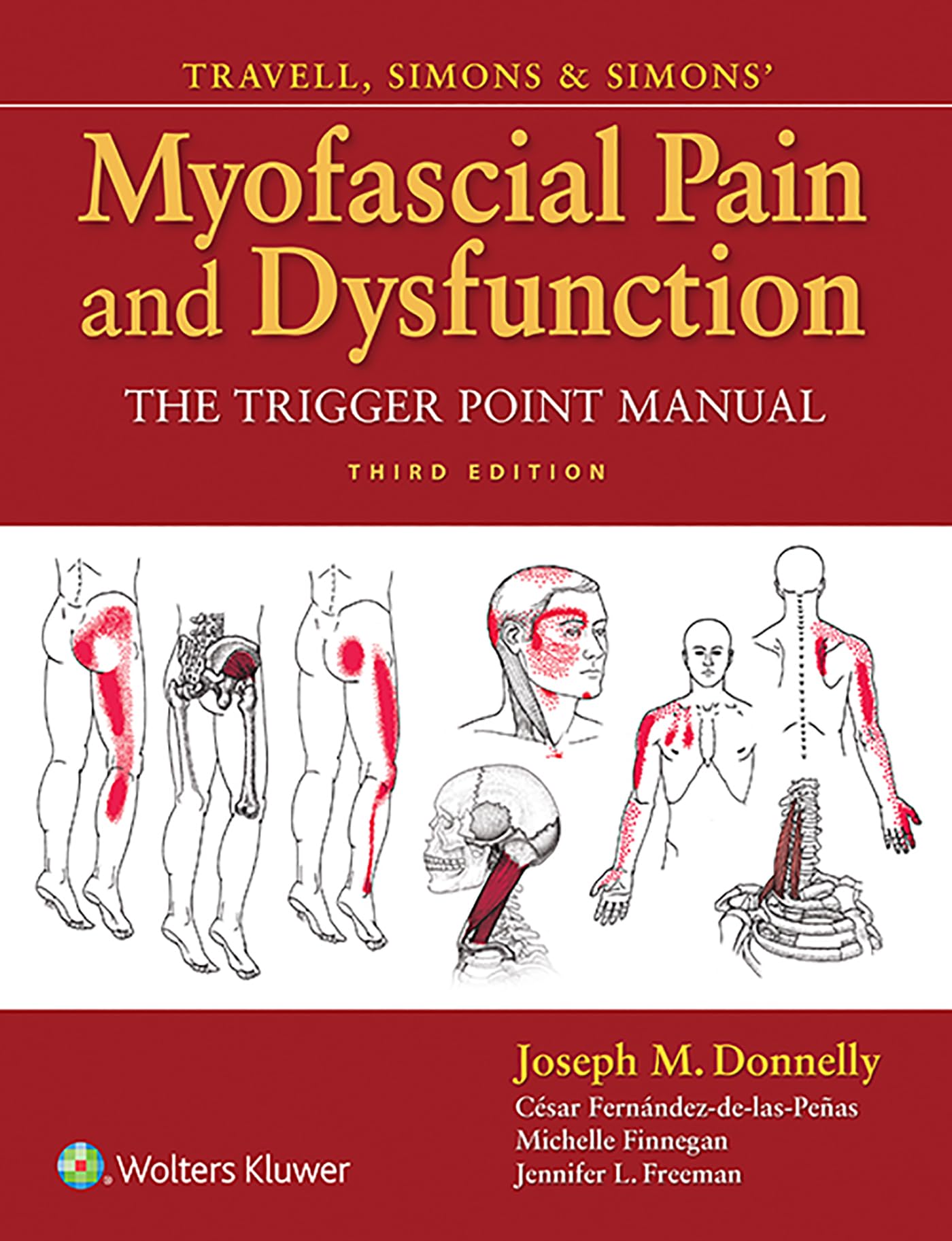 LWW  Travell, Simons & Simons Myofascial Pain and Dysfunction: The Trigger Point Manual