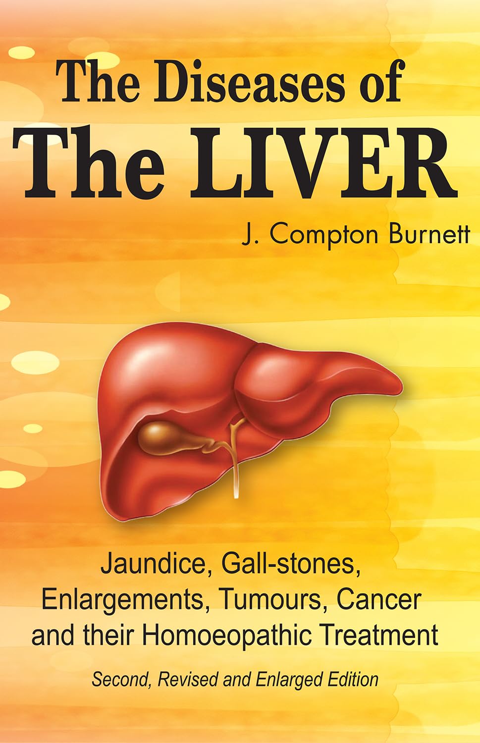 The Diseases Of The Liver - Jaundice, Gall-Stones, Enlargements, Tumours, Cancer And Their Homeopathic Treatment (Second Revised And Enlarged Edition)