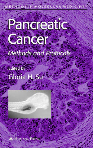 Pancreatic Cancer: Methods and Protocols (Methods in Molecular Medicine, 103),New