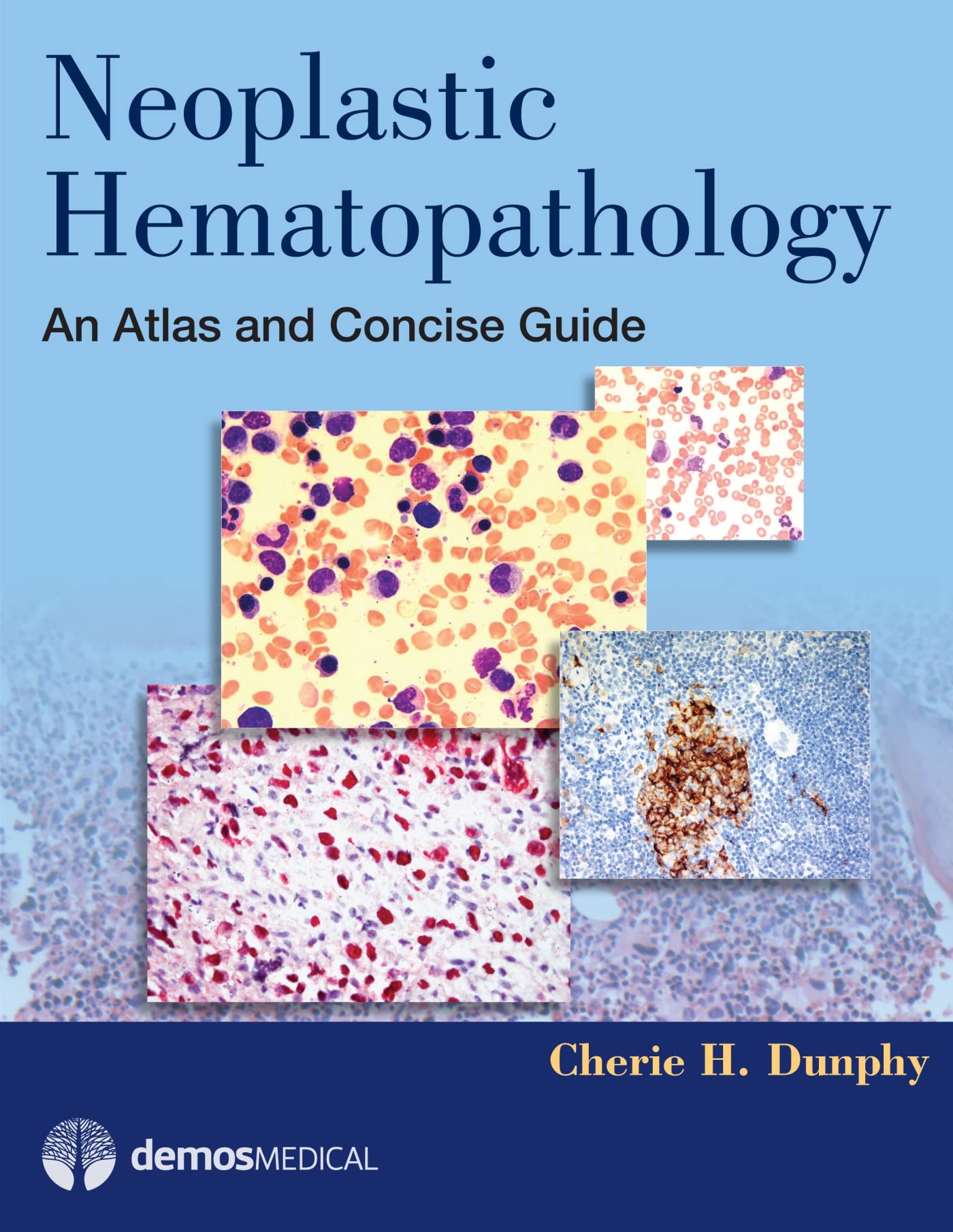 Neoplastic Hematopathology: An Atlas and Concise Guide,Used