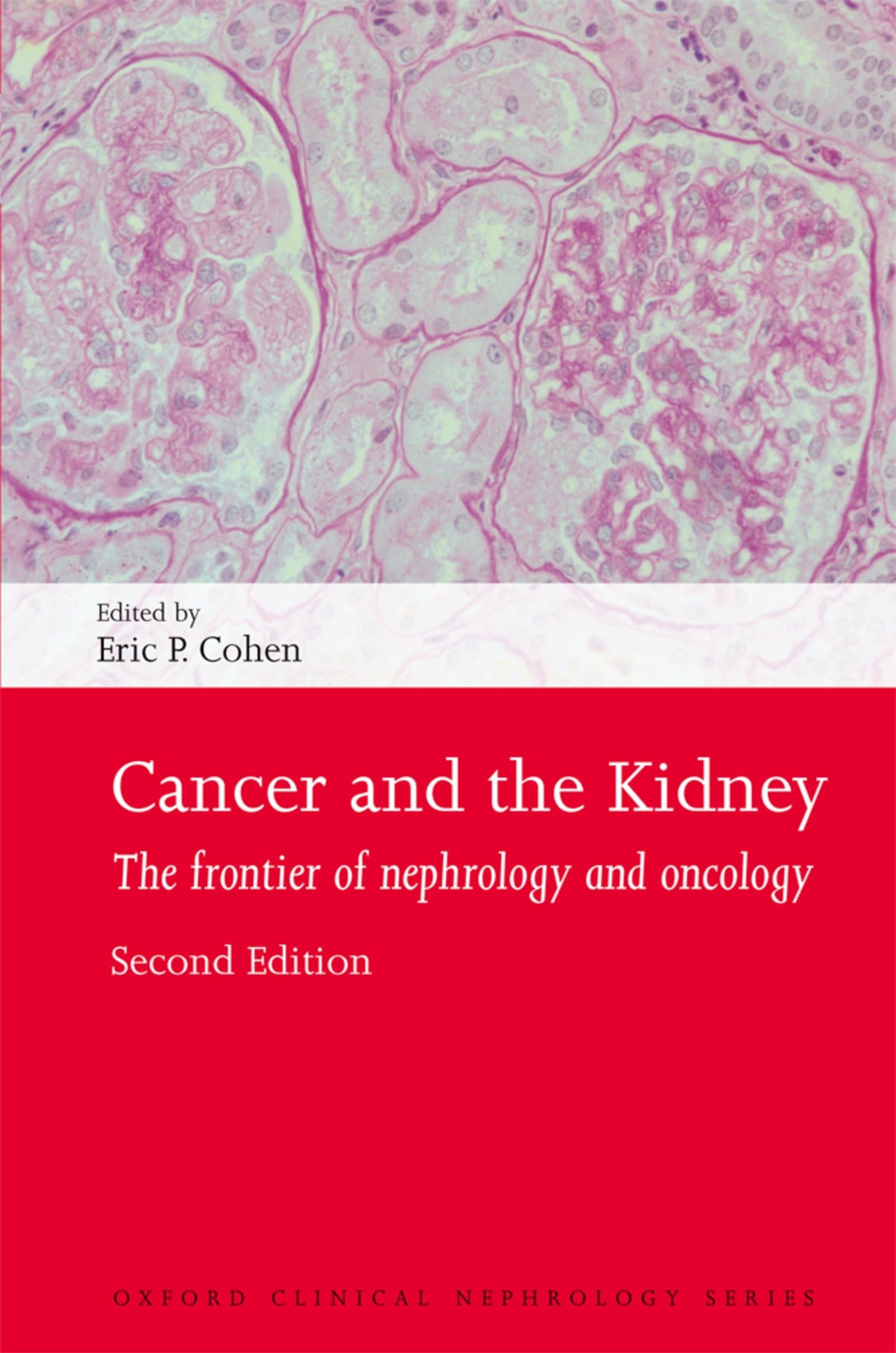 Cancer and the Kidney (Oxford Clinical Nephrology Series),Used