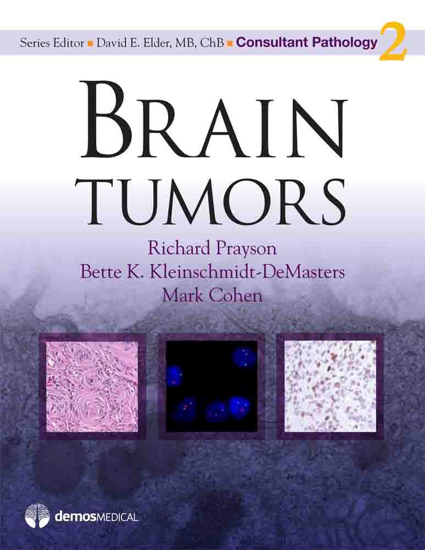 Brain Tumors (Consultant Pathology, Volume 2),Used