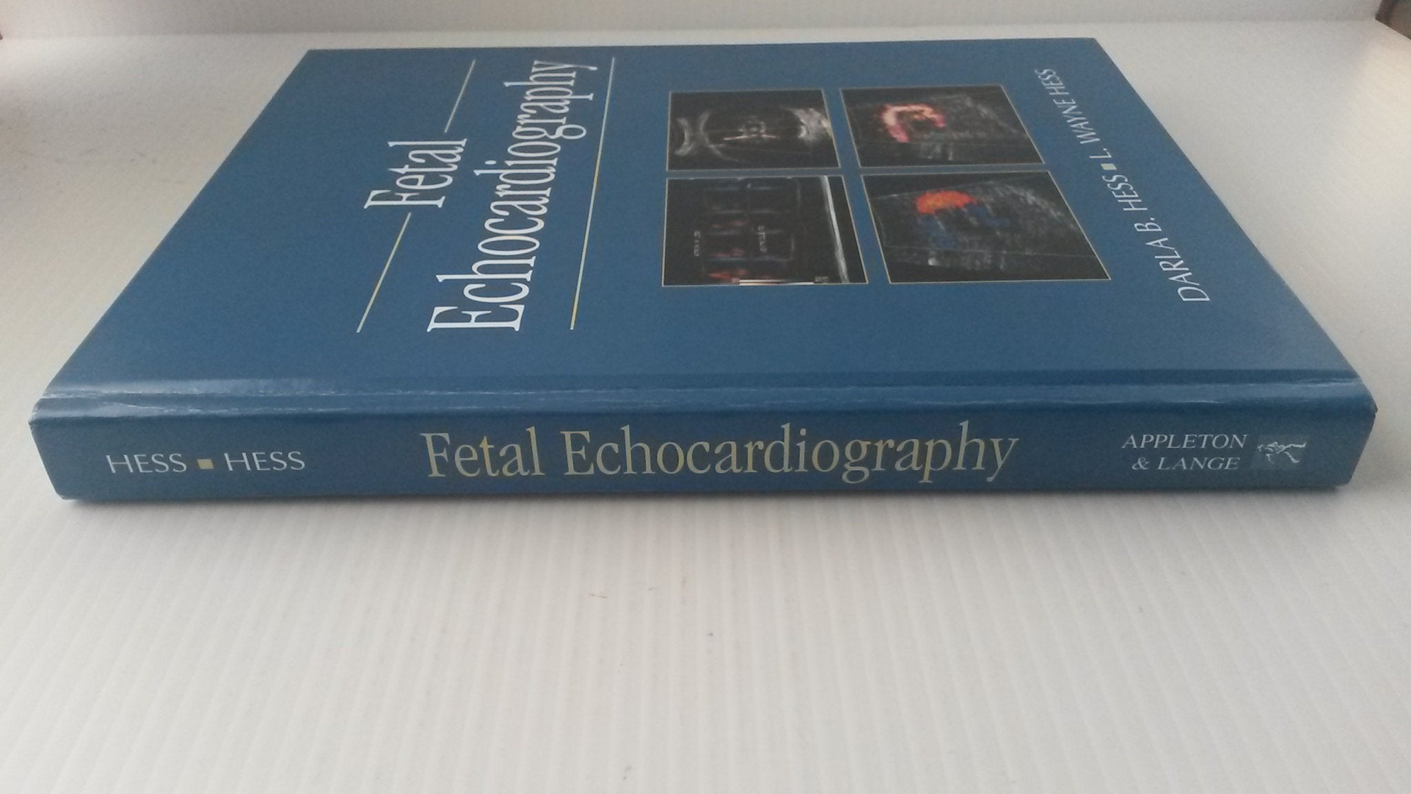 Fetal Echocardiography,Used