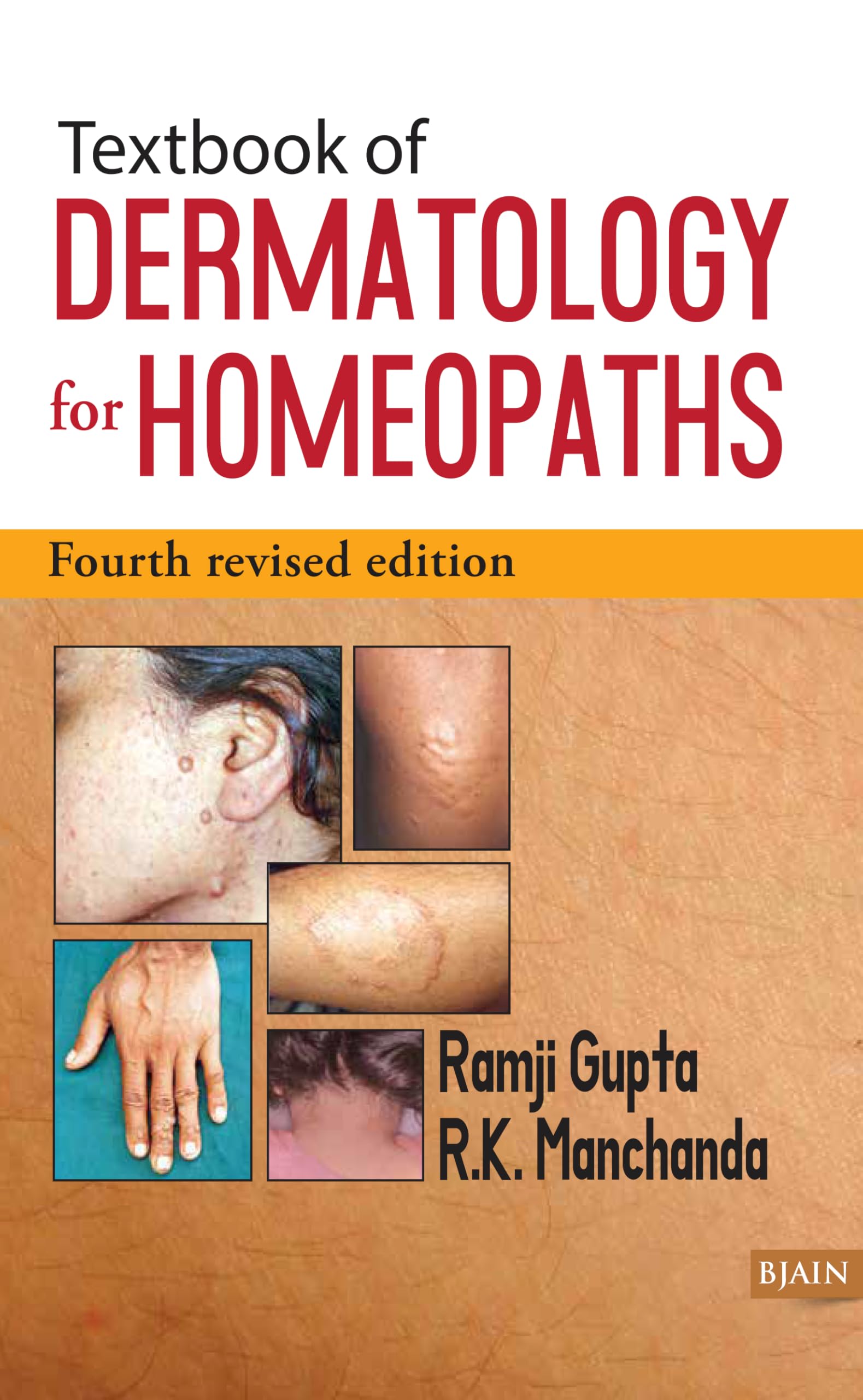 Textbook Of Dermatology For Homoeopaths - 4Th Revised Edition