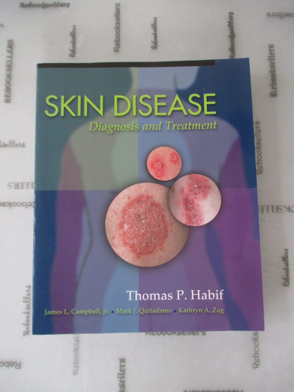 Skin Disease: Diagnosis And Treatment,New