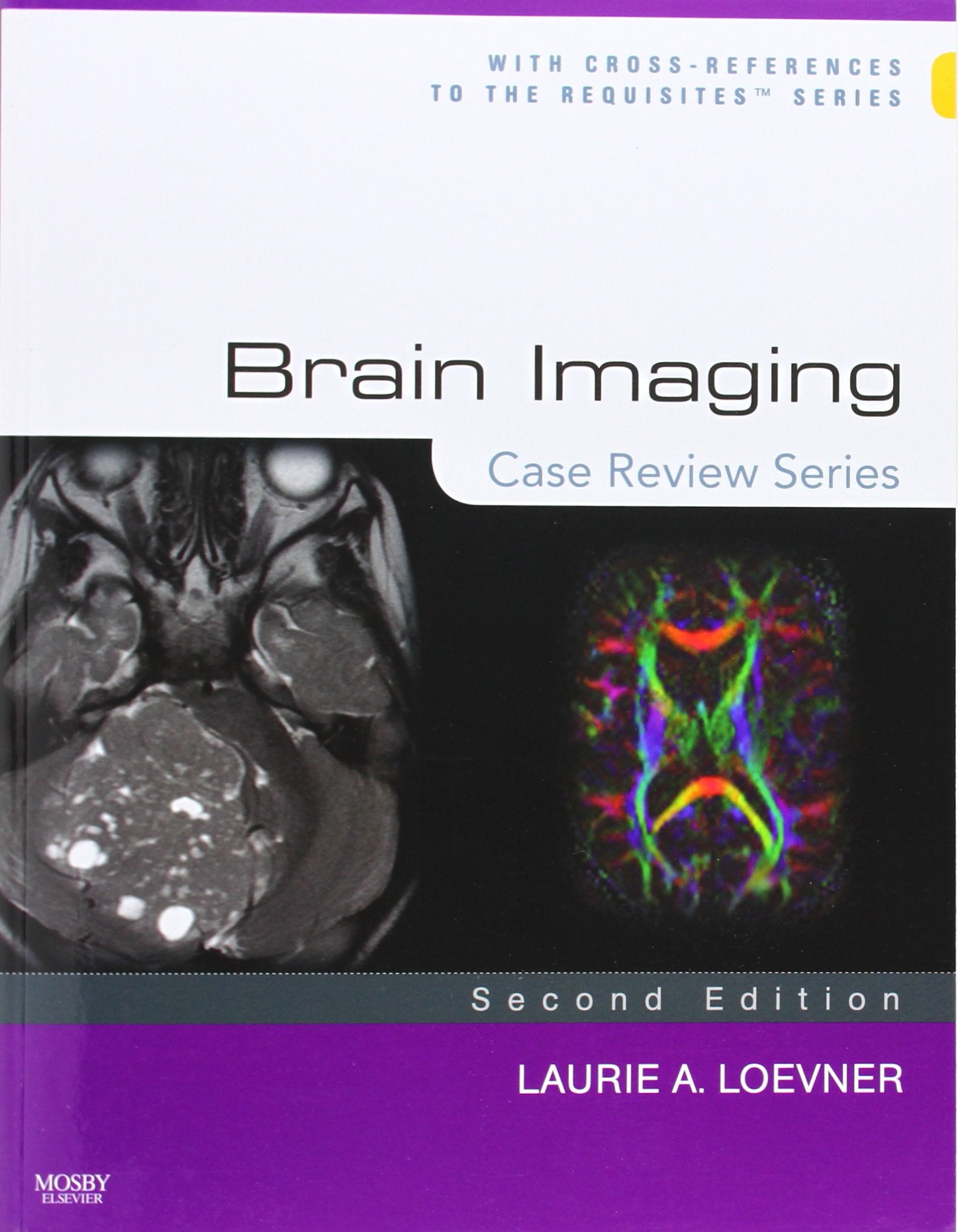 Brain Imaging: Case Review Series,Used