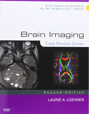 Brain Imaging: Case Review Series,Used