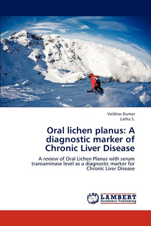 Oral lichen planus: A diagnostic marker of Chronic Liver Disease: A review of Oral Lichen Planus with serum transaminase level a,Used