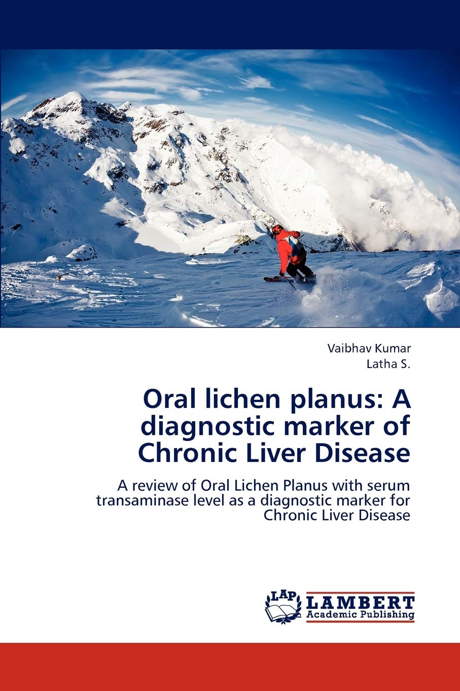 Oral lichen planus: A diagnostic marker of Chronic Liver Disease: A review of Oral Lichen Planus with serum transaminase level a,Used