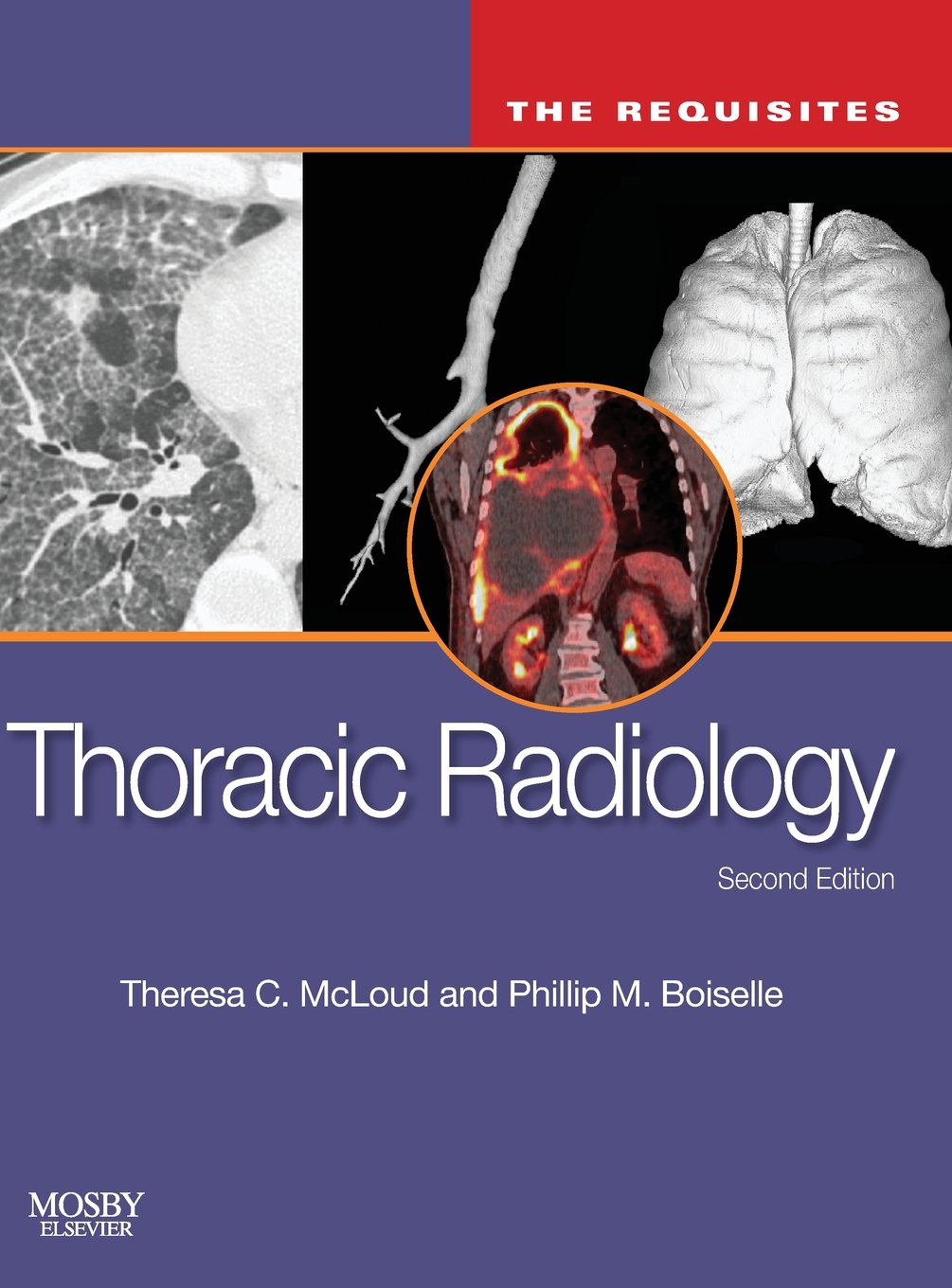 Thoracic Radiology: The Requisites (Requisites in Radiology),Used