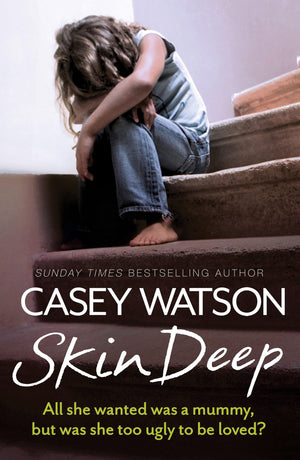 Skin Deep: All she wanted was a mummy, but was she too ugly to be loved?,Used