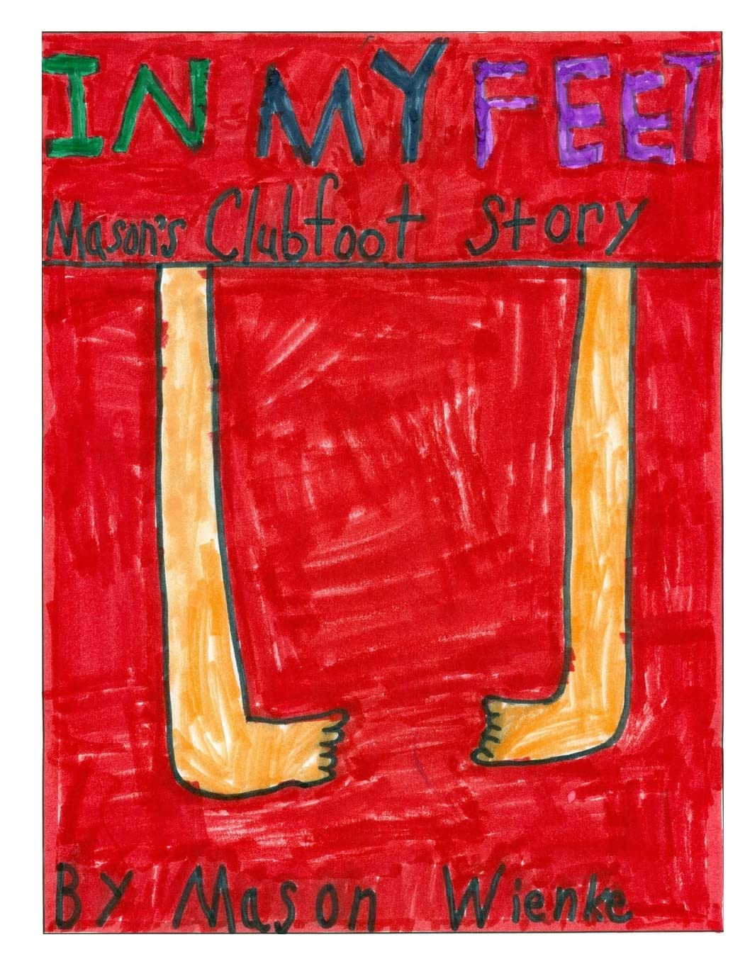 In My Feet: Mason's Clubfoot Story,Used