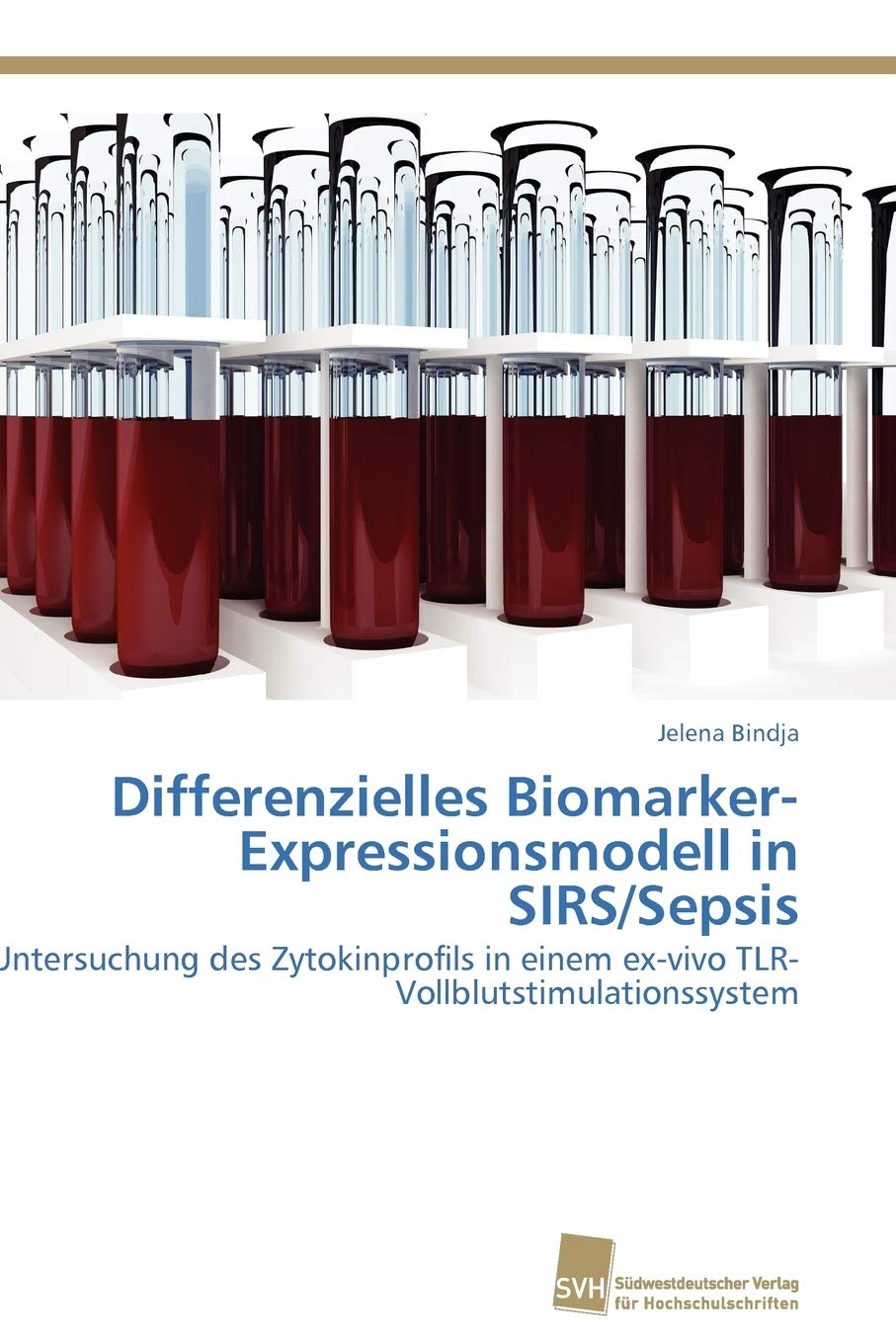 Differenzielles BiomarkerExpressionsmodell in SIRS/Sepsis: Untersuchung des Zytokinprofils in einem exvivo TLRVollblutstimula,Used