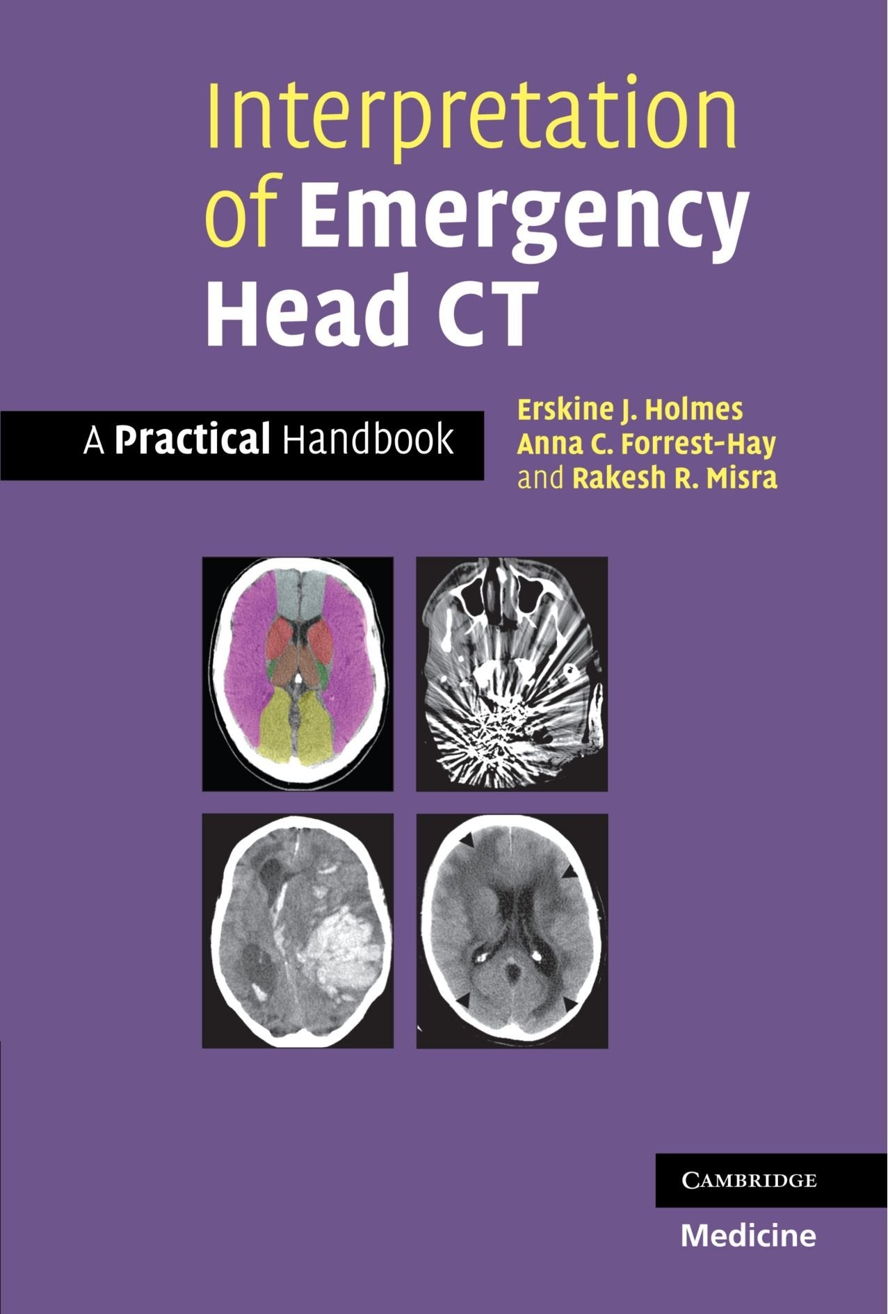 Interpretation Of Emergency Head Ct: A Practical Handbook,New