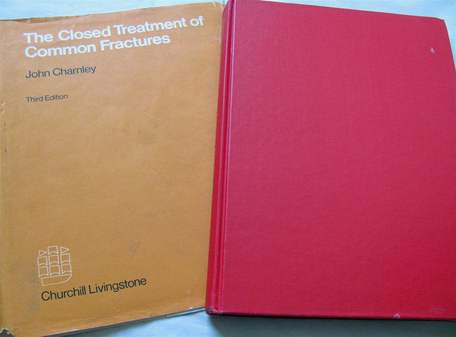 Closed Treatment of Common Fractures