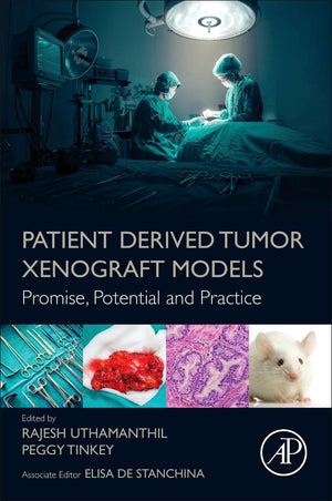 Patient Derived Tumor Xenograft Models: Promise, Potential and Practice,Used