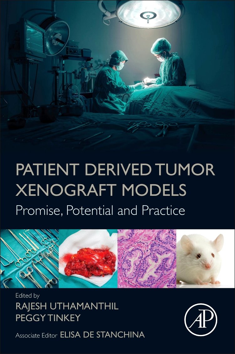 Patient Derived Tumor Xenograft Models: Promise, Potential and Practice,Used