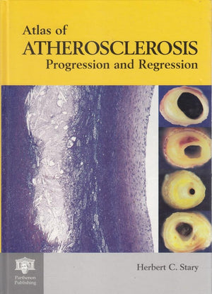 An Atlas of Atherosclerosis Progression and Regression,Used