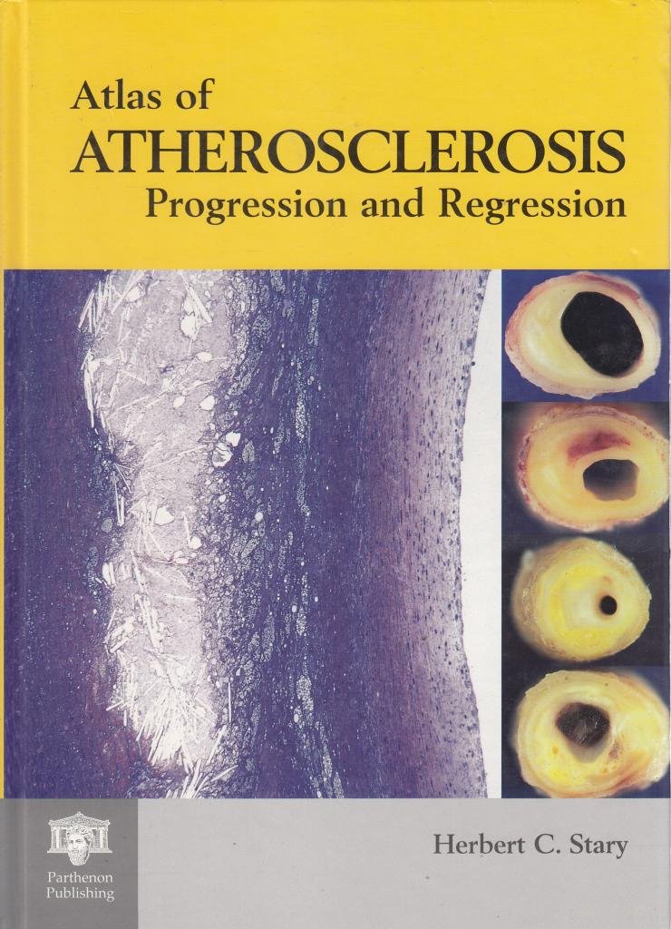 An Atlas of Atherosclerosis Progression and Regression,Used