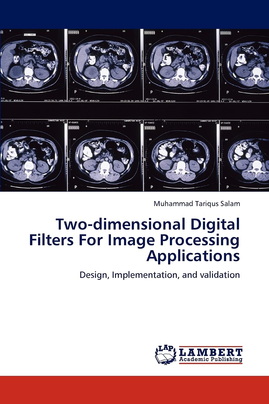Twodimensional Digital Filters For Image Processing Applications: Design, Implementation, and validation,Used
