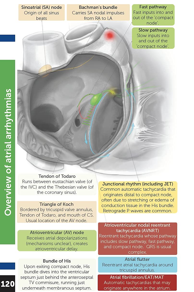 Boston Children's Hospital Cardiac ICU Manual For Bedside Providers  an illustrated handbook of congenital heart disease,New