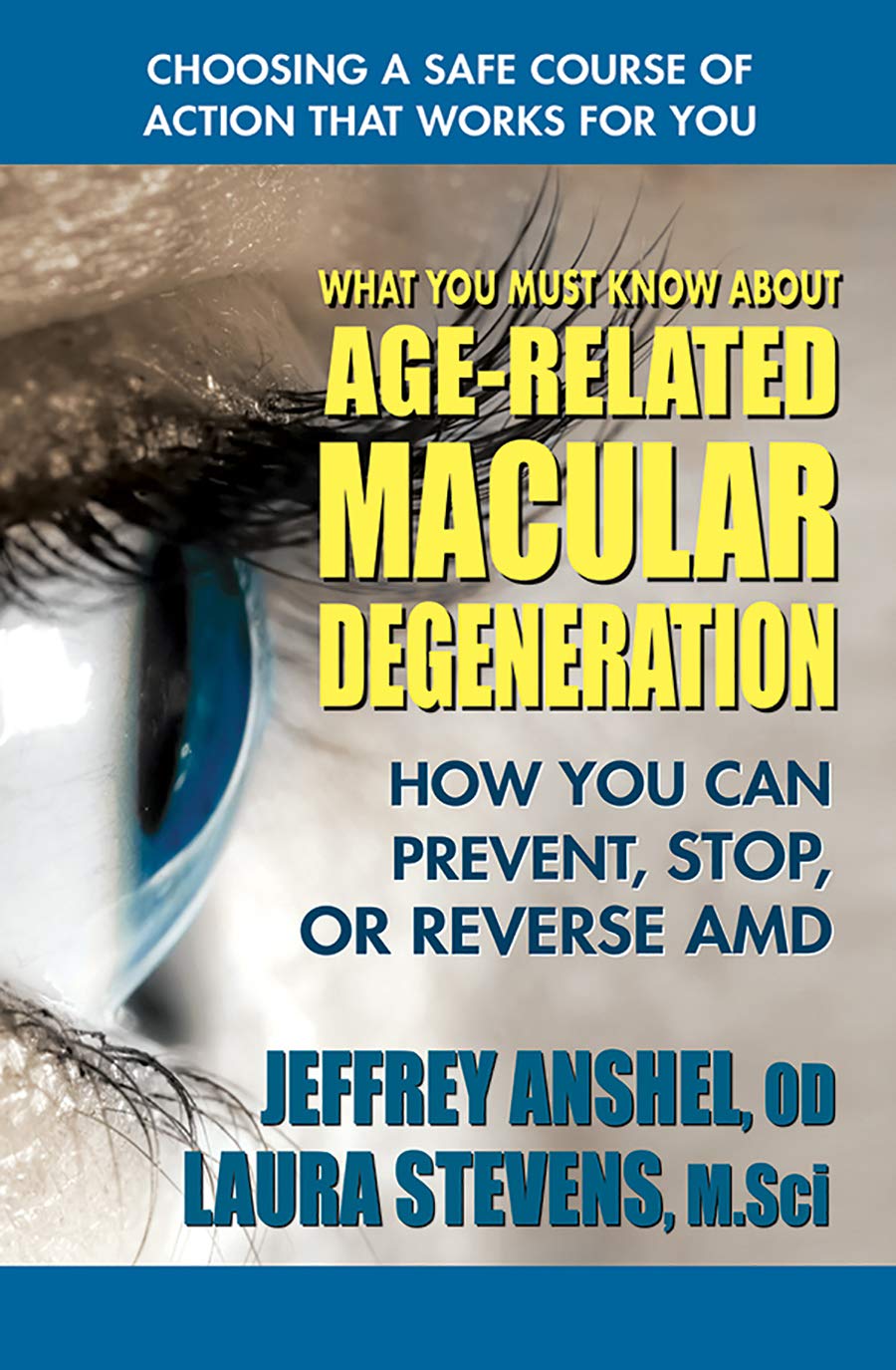 What You Must Know About Agerelated Macular Degeneration: How You Can Prevent, Stop, Or Reverse Amd