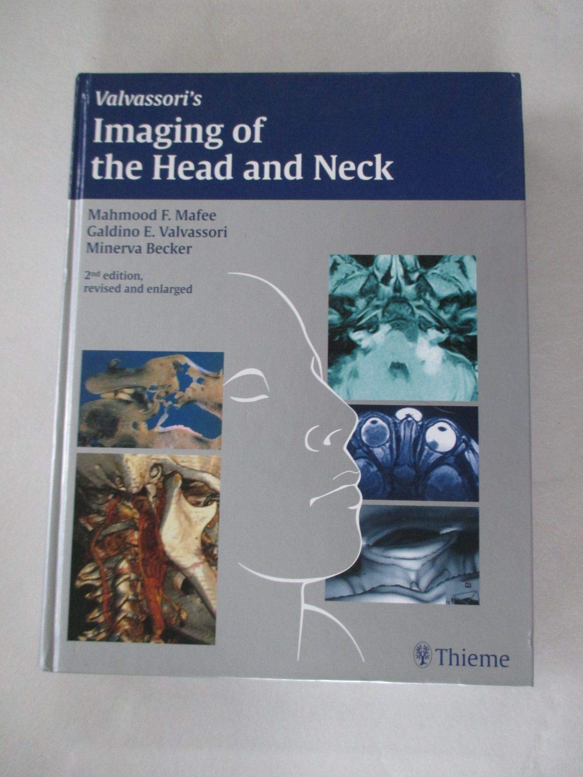 Imaging of the Head and Neck,Used