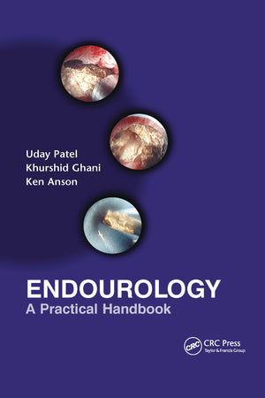 Endourology: A Practical Handbook,New