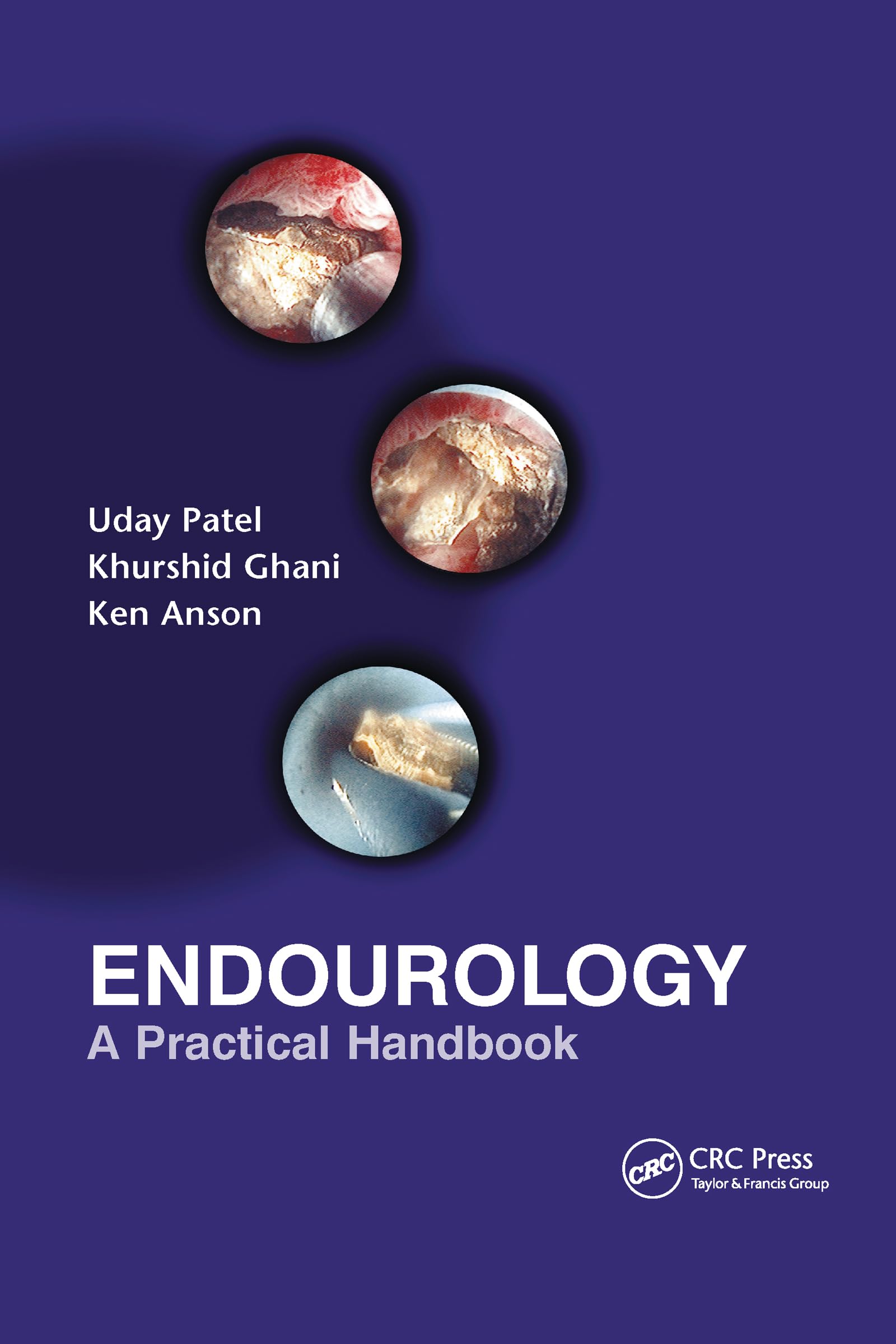 Endourology: A Practical Handbook,Used